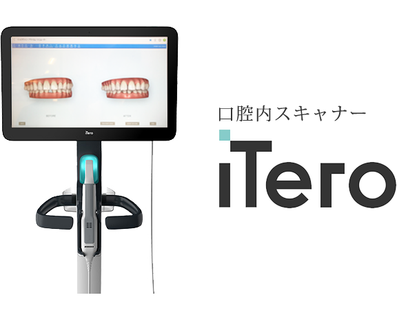 口腔内スキャナーiTero(アイテロ)5Dを導入